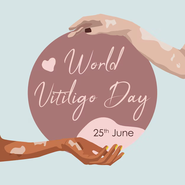 How to Support Someone with Vitiligo: A Guide to Empathy and Awarenes